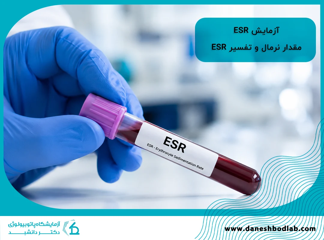 آزمایش ESR چیست؟ مقدار نرمال و تفسیر ESR در آزمایش خون