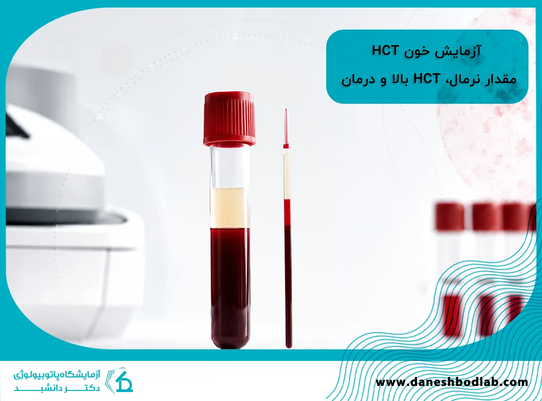 HCT در آزمایش خون چیست؟ مقدار نرمال، HCT بالا و درمان
