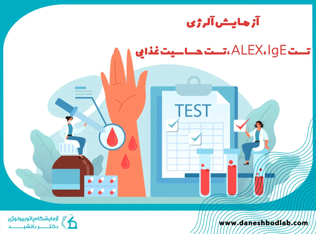 آزمایش آلرژی در شیراز | تست ALEX، IgE، تست حساسیت غذایی و کودکان