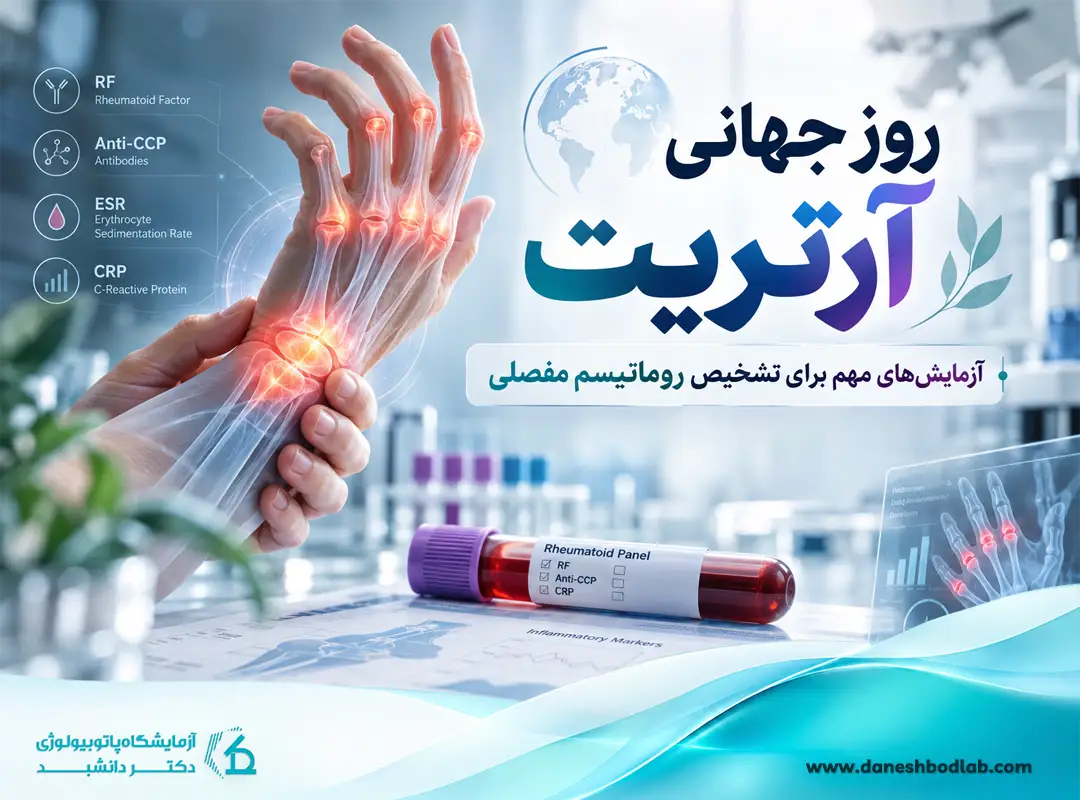آزمایش روماتیسم چیست؟ تفسیر RF و Anti-CCP و عدد نرمال
