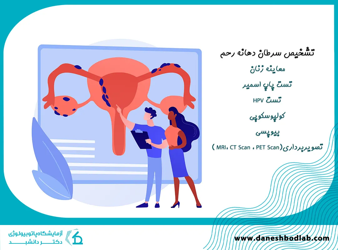 تشخیص سرطان دهانه رحم