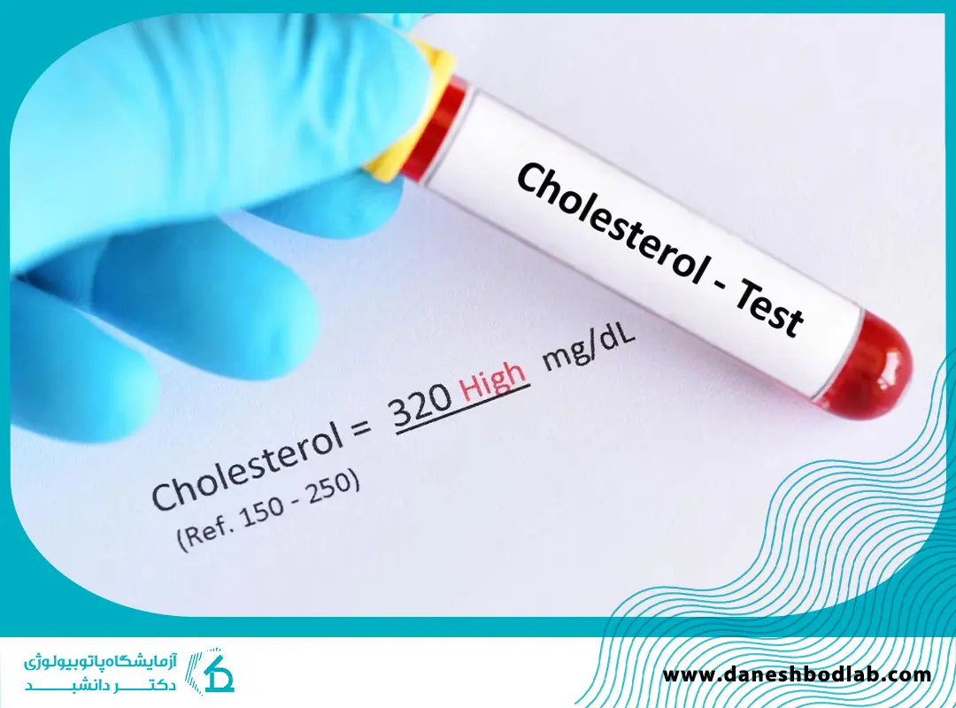 کلسترول در آزمایش خون؛ نشانه‌ها، تفسیر نتایج